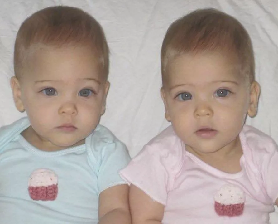 They called them the world’s most beautiful twins 10 years ago – but now look what the girls look like today
