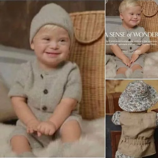 A toddler with Down syndrome is shown in an ad for Banana Republic’s new baby line.