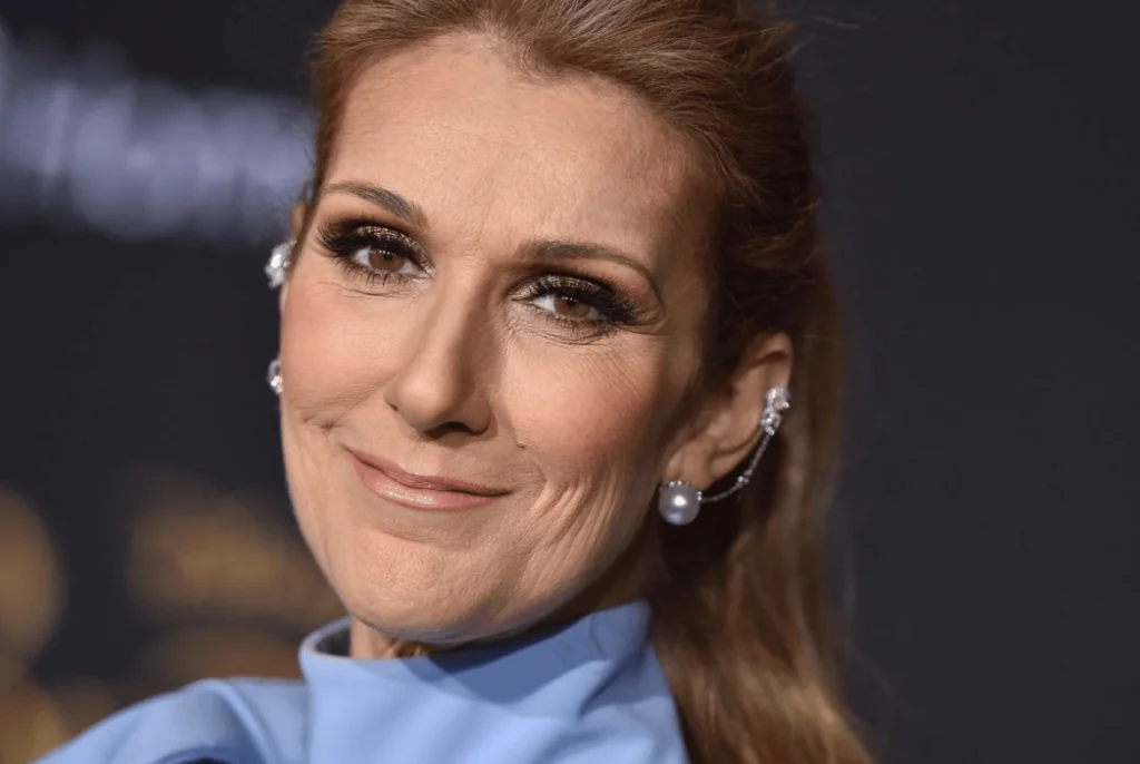 Celine Dion Shares Her Secret to an Instant Facelift Without Needles